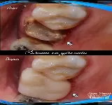 CENTRO ODONTOLóGICO CLINIORAL SANTA MARTA