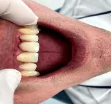 ODONTOLOGíA INTEGRAL JULIO MEJíA VALDIVIESO